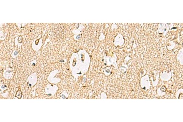 LRRC28 antibody