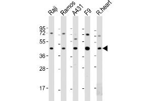 All lanes : Anti-MCL1 Antibody (BH3 Domain Specific) at 1:2000 dilution Lane 1: Raji whole cell lysate Lane 2: Ramos whole cell lysate Lane 3: A431 whole cell lysate Lane 4: F9 whole cell lysate Lane 5: A20 whole cell lysate Lysates/proteins at 20 μg per lane.