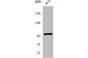 Western Blot analysis of HeLa cells using Phospho-NFκB-p105 (S893) Polyclonal Antibody (NFKB1 antibody  (pSer893))
