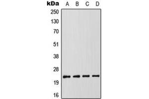 Western blot analysis of RAIDD expression in MCF7 (A), K562 (B), SP2/0 (C), PC12 (D) whole cell lysates. (CRADD antibody  (Center))