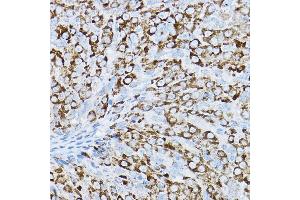Immunohistochemistry of paraffin-embedded rat ovary using P2RY14 Rabbit pAb (ABIN6131673, ABIN6145126, ABIN6145127 and ABIN6224204) at dilution of 1:200 (40x lens). (P2RY14 antibody  (AA 209-338))