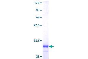 CRIP1 Protein (AA 1-77) (GST tag)