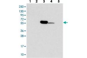Western blot analysis of Lane 1: RT-4, Lane 2: U-251 MG, Lane 3: Human Plasma, Lane 4: Liver, Lane 5: Tonsil with C11orf80 polyclonal antibody  at 1:250-1:500 dilution. (C11ORF80 antibody)