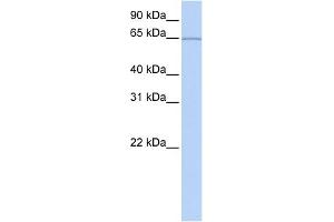 WB Suggested Anti-KIAA0020 Antibody Titration:  0. (KIAA0020 antibody  (Middle Region))