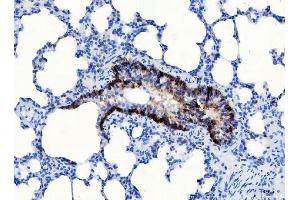 IHC analysis of CD166/ALCAM using anti-CD166/ALCAM antibody (ABIN5518801).