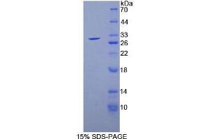 SDS-PAGE (SDS) image for Glutathione S-Transferase theta 2 (GSTT2) (AA 15-235) protein (His tag) (ABIN2125029) (GSTT2 Protein (AA 15-235) (His tag))