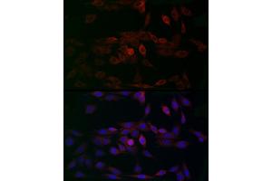 Immunofluorescence (IF) image for anti-Mitochondrial Calcium Uniporter (MCU) (AA 1-351) antibody (ABIN7268549)