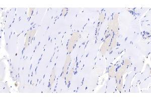 Detection of MYH7 in Human Skeletal muscle Tissue using Monoclonal Antibody to Myosin Heavy Chain 7, Cardiac Muscle, Beta (MYH7) (MYH7 antibody  (AA 1777-1935))