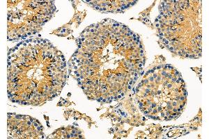 ABIN6259457 and ABIN6275785 at 1/100 staining Mouse testis tissue by IHC-P.
