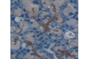 Used in DAB staining on fromalin fixed paraffin- embedded Kidney tissue (IL20RA antibody  (AA 273-543))