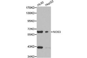 Western blot analysis of extracts of various cell lines, using NOS3 antibody. (ENOS antibody  (AA 1-120))