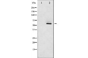 Western blot analysis of Src phosphorylation expression in COLO205 whole cell lysates,The lane on the left is treated with the antigen-specific peptide.