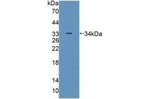 Detection of Recombinant PLIN4, Human using Polyclonal Antibody to Perilipin 4 (PLIN4) (PLIN4 antibody  (AA 349-656))