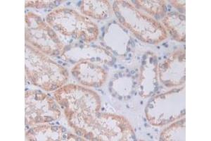 Figure. (GDF3 antibody  (AA 251-364))