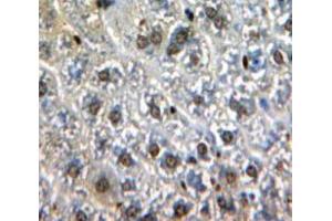 Used in DAB staining on fromalin fixed paraffin-embedded Liver tissue (GATA1 antibody  (AA 42-292))