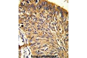 Immunohistochemistry (IHC) image for anti-Peroxiredoxin 3 (PRDX3) antibody (ABIN3001722) (Peroxiredoxin 3 antibody)