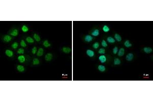 ICC/IF Image MTA1 antibody [C1C3] detects MTA1 protein at nucleus by immunofluorescent analysis. (MTA1 antibody)