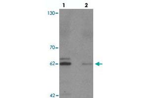 Western blot analysis of KCNK13 in rat brain tissue with KCNK13 polyclonal antibody  at 0.