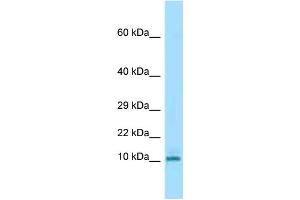 WB Suggested Anti-Krtap3-3 Antibody Titration: 1. (KRTAP3-3 antibody  (N-Term))