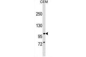 PTHB1 Antibody (C-term) (ABIN1537602 and ABIN2849688) western blot analysis in CEM cell line lysates (35 μg/lane). (BBS9 antibody  (C-Term))