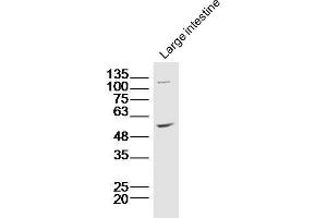 Lane 1: Mouse intestine lysates probed with ZnT-1 Polyclonal Antibody, Unconjugated  at 1:300 overnight at 4˚C. (SLC30A1 antibody  (AA 131-330))