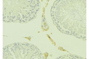 Immunohistochemistry (IHC) image for anti-KiSS-1 Metastasis-Suppressor (KISS1) (Internal Region) antibody (ABIN6266238)
