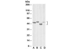Western blot testing of mouse brain (lane A), rat brain (lane B), mouse thymus (lane C) and rat thymus (lane D) lysates with MEIS2 antibody at 0. (MEIS2 antibody)