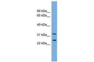 Image no. 1 for anti-Zinc Finger Protein 265 (Zranb2) (AA 143-192) antibody (ABIN6744705) (ZNF265 antibody  (AA 143-192))