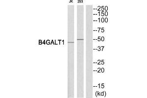 Western Blotting (WB) image for anti-UDP-Gal:betaGlcNAc beta 1,4 Galactosyltransferase, Polypeptide 1 (B4GALT1) (C-Term) antibody (ABIN1850908) (B4GALT1 antibody  (C-Term))