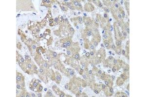 Immunohistochemistry of paraffin-embedded Human liver damage using ALKBH4 Polyclonal Antibody at dilution of 1:100 (40x lens).