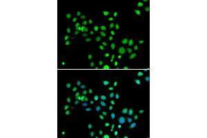 Immunofluorescence analysis of U20S cell using H2AFY antibody. (H2AFY antibody)