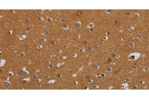 Immunohistochemistry of paraffin-embedded Human brain using CSH1 Polyclonal Antibody at dilution of 1:40 (CSH1 antibody)