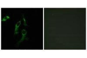 Immunofluorescence analysis of HepG2 ells, using HARS antibody. (HARS1/Jo-1 antibody  (C-Term))