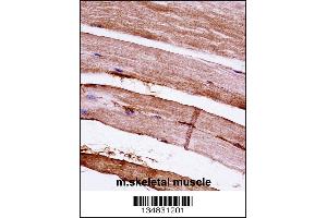 Mouse Mapkapk3 Antibody immunohistochemistry analysis in formalin fixed and paraffin embedded mouse skeletal muscle followed by peroxidase conjugation of the secondary antibody and DAB staining.