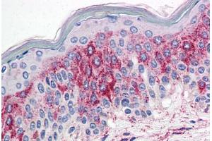 Skin, Human: Formalin-Fixed, Paraffin-Embedded (FFPE) (HTR2A antibody  (N-Term))