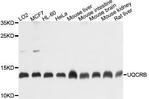 Western blot analysis of extracts of various cell lines, using UQCRB antibody (ABIN4905562) at 1:1000 dilution.