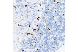 Immunohistochemistry of paraffin-embedded mouse brain using Somatostatin (SST) Rabbit mAb (ABIN7270492) at dilution of 1:1000 (40x lens). (Somatostatin antibody  (AA 23-116))