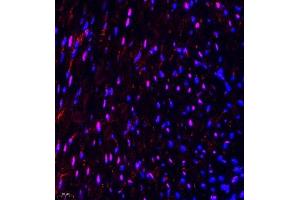 Immunofluorescence of paraffin embedded mouse heart using NSD3 (ABIN7076233) at dilution of 1:650 (400x lens) (WHSC1L1 antibody)