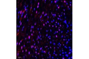 Immunofluorescence of paraffin embedded mouse heart using NSD3 (ABIN7076233) at dilution of 1:650 (400x lens) (WHSC1L1 antibody)