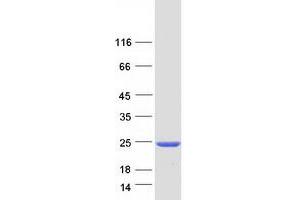 Validation with Western Blot (CENPM Protein (Transcript Variant 1) (Myc-DYKDDDDK Tag))