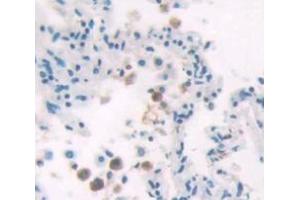 Figure. (HIST1H2AD antibody  (AA 2-130))
