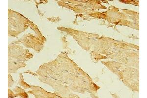 MYH7B antibody  (AA 1-176)