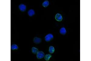 IF analysis of Il2ra using anti-Il2ra antibody (ABIN7600684). (CD25 antibody  (AA 22-268))