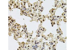 Immunohistochemistry of paraffin-embedded Rat lung using ZNF408 Polyclonal Antibody at dilution of 1:100 (40x lens).