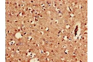 Immunohistochemistry of paraffin-embedded human brain tissue using ABIN7153285 at dilution of 1:100 (KCNJ3 antibody  (AA 350-487))