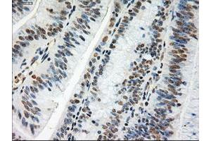 Image no. 5 for anti-Myc Proto-Oncogene protein (MYC) antibody (ABIN1497011) (c-MYC antibody)