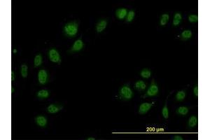 Image no. 3 for anti-Cullin-Associated and Neddylation-Dissociated 1 (CAND1) (AA 1-101) antibody (ABIN599270) (CAND1 antibody  (AA 1-101))