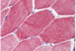 Human Skeletal Muscle (formalin-fixed, paraffin-embedded) stained with PAK2 antibody ABIN214460 at 2. (PAK2 antibody  (C-Term))