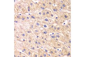 Immunohistochemistry of paraffin-embedded human liver injury using TXN2 antibody. (TXN2 antibody)
