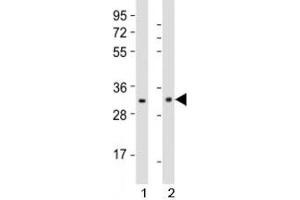 Western blot testing of Nkx2. (NK2 Homeobox 5 antibody  (AA 98-133))